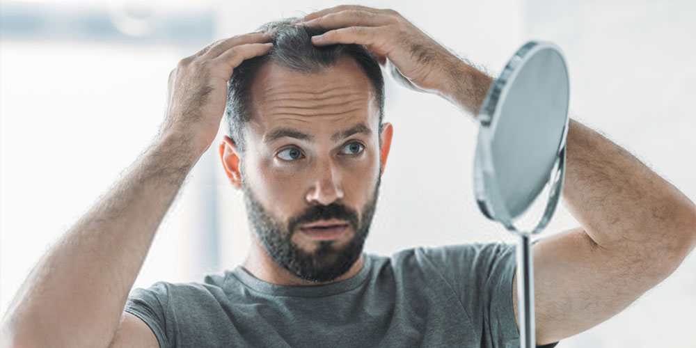Best Hair Loss Treatment Options For Men