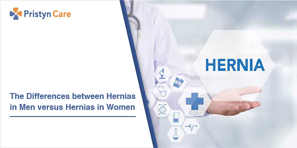 The Differences between Hernias in Men versus Hernias in Women