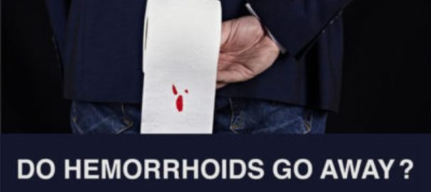 Do Hemorrhoids Go Away?