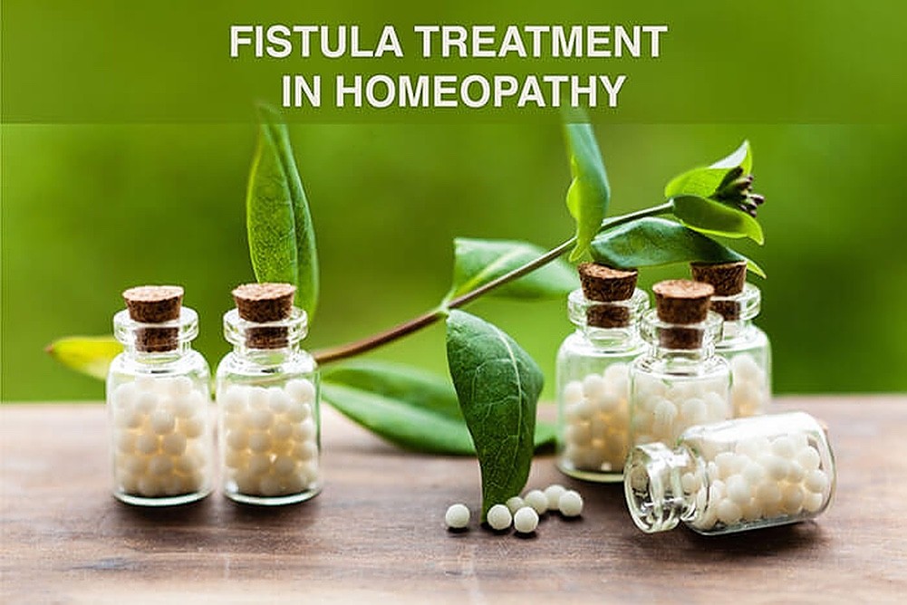 Homeopathic Treatment for Piriformis - Abhi Homeo, Ranchi