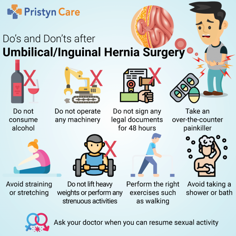 Things To Dos And Donts During Hernia Preventing A Hernia