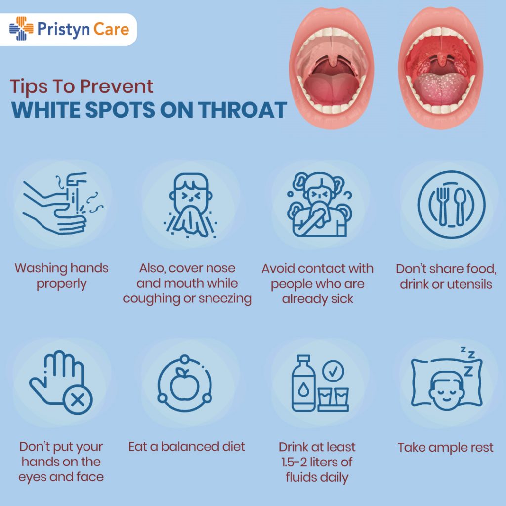 White Spots On Throat Symptoms