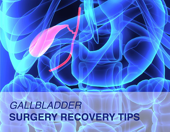 gallbladder-surgery-recovery-tips