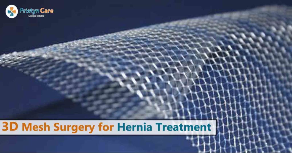 The Health Hub Inguinal Hernia Repair Overview Hot Sex Picture 3782