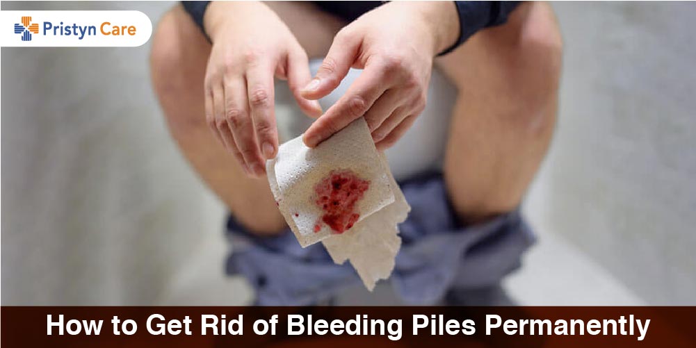 how-to-get-rid-of-bleeding-piles-permanently-pristyn-care