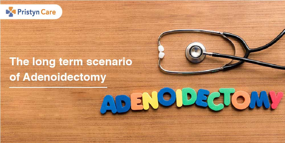 The long term scenario of Adenoidectomy