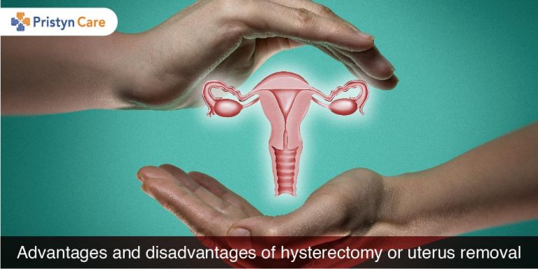 Hysterectomy Uterus Removal Surgery Is It For You