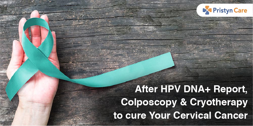 After HPV DNA+ Report, Colposcopy and Cryotherapy to cure Your Cervical Cancer