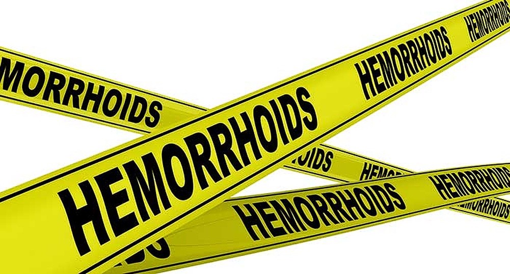 can-piles-kill-you-hemorrhoids-frequently-asked-question