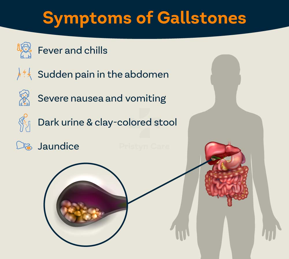 6 Effective Home Remedies for Gallbladder stone Pain | Sprint Medical