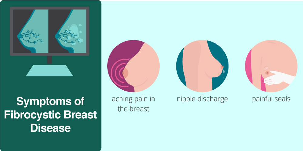 Cyst in breast pain relief - How to Heal Dense, Fibrotic & Tissue