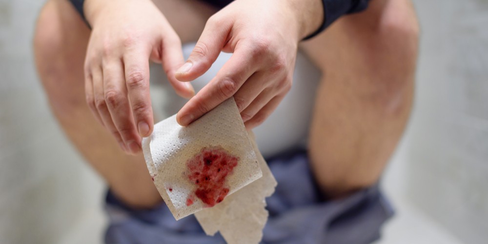 Blood in your poop: what it looks like & what it could mean 