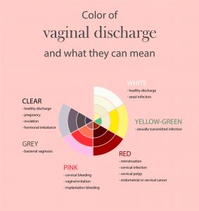 Is White or Yellow Vaginal Discharge A Call For Concern? - Pristyn Care