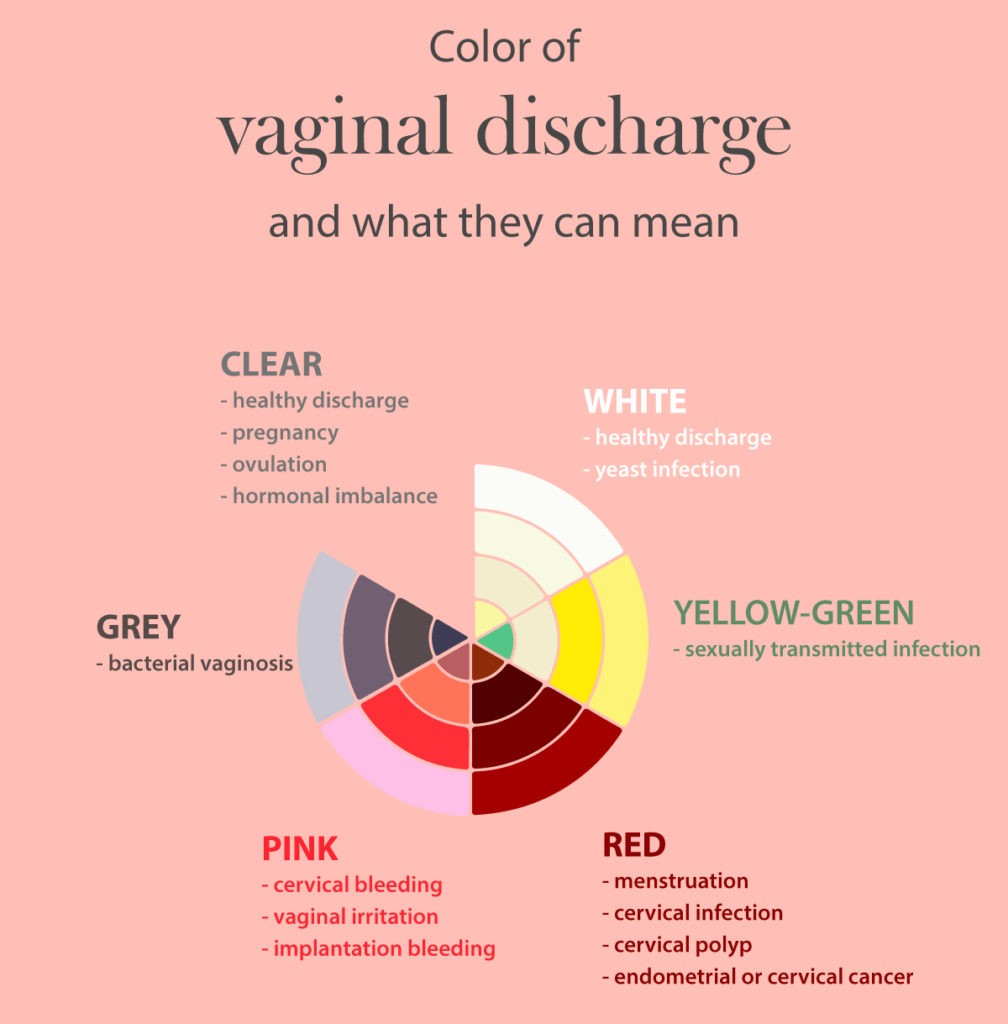 Vaginal Discharge (Early Pregnancy Discharge) - Leukorrhea During
