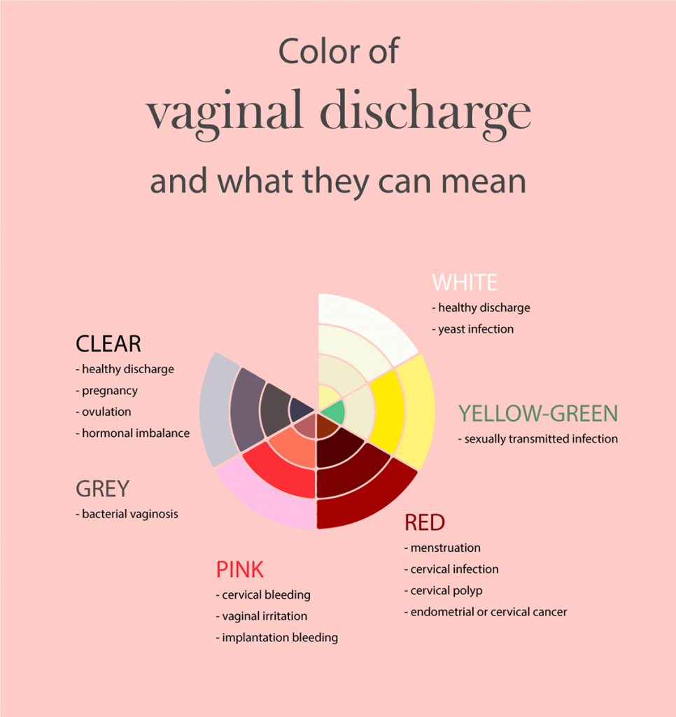 Vaginal Discharge Colors and What Causes Them