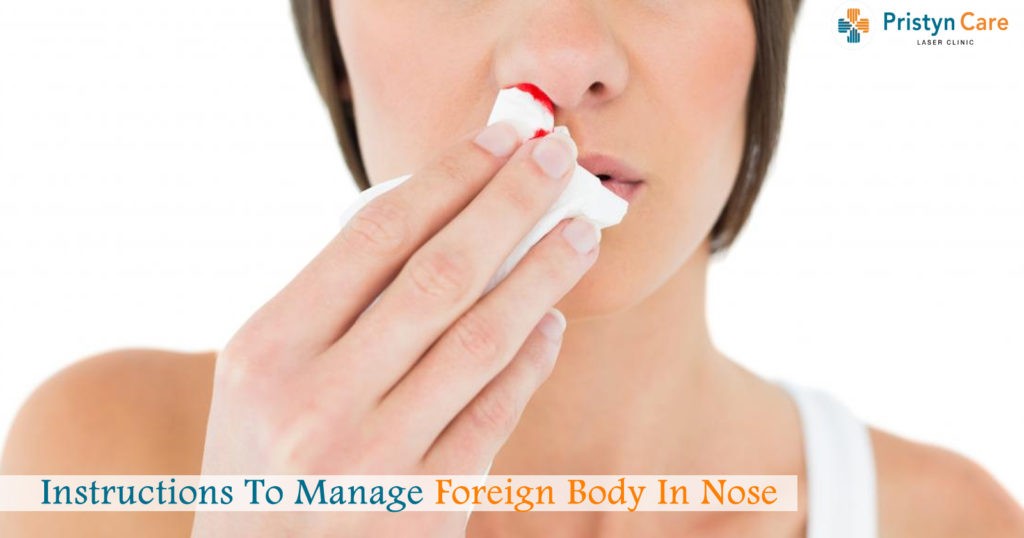 Instructions to Manage foreign body in Nose