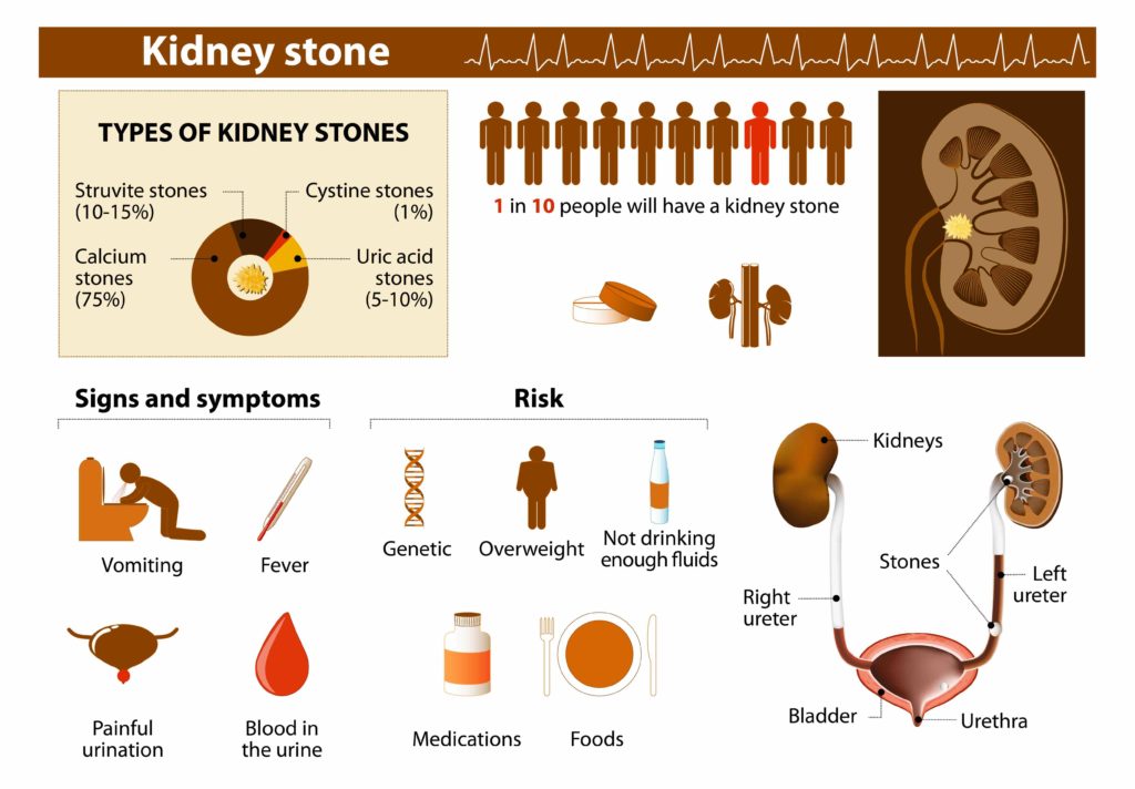 carbonated-beverages-may-be-hurting-your-kidneys-pristyn-care