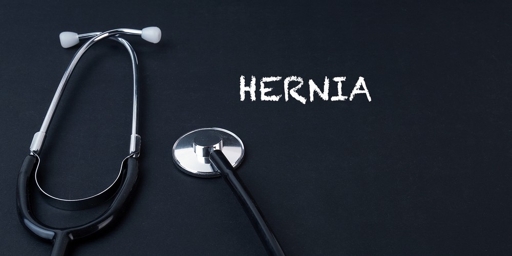 Femoral Hernia - Causes, Risk Factors, Symptoms, Complications