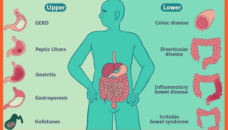 what-causes-upper-abdominal-pain-2023