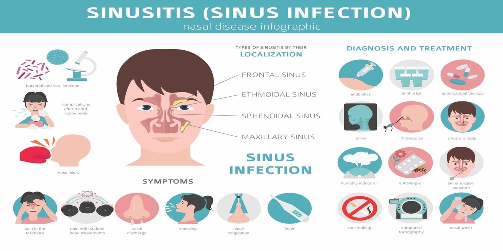 How do I tell if I have a sinus or migraine? - Pristyn Care