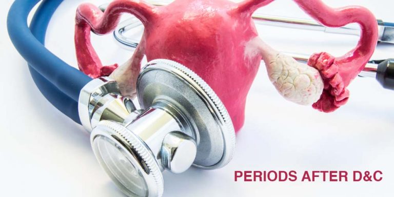 How and When does a woman have periods after D&C procedure? - Pristyn Care