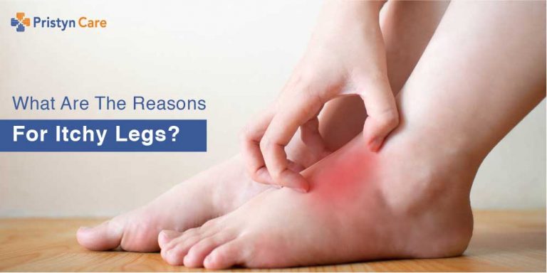 What Are The Reasons For Itchy Legs Pristyn Care