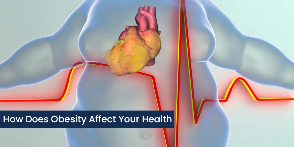 how does obesity affect your health