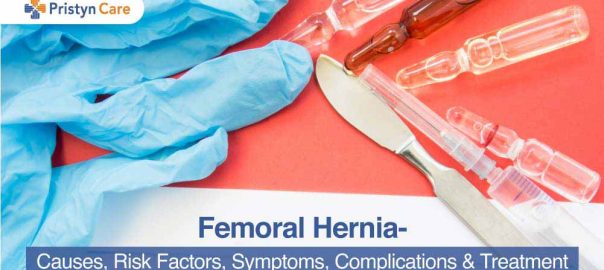 Femoral Hernia – Causes, Risk Factors, Symptoms, Complications & Treatment