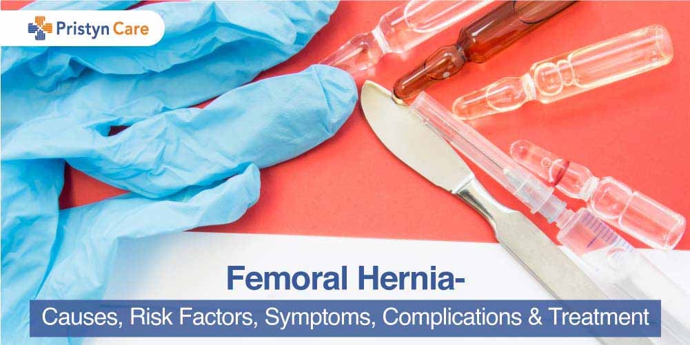 Femoral Hernia - Causes, Risk Factors, Symptoms, Complications & Treatment  - Pristyn Care