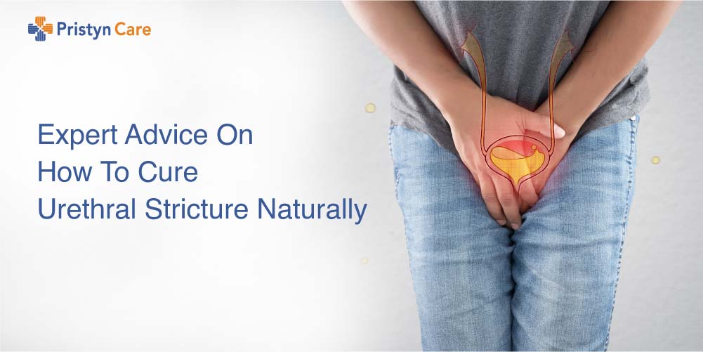 Expert Advice On How To Cure Urethral Stricture Naturally? - Pristyn Care