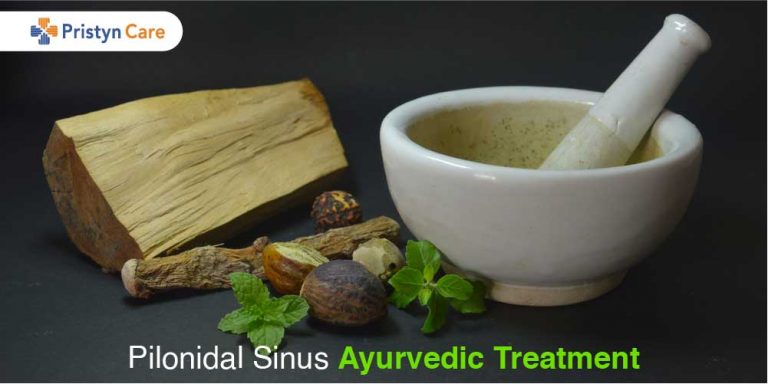 Pilonidal Sinus Ayurvedic Treatment Pristyn Care