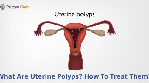 Types Of Uterine Fibroids Pristyn Care