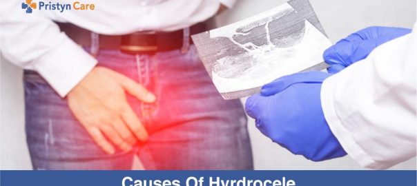 what are the causes of hydrocele pristyn care