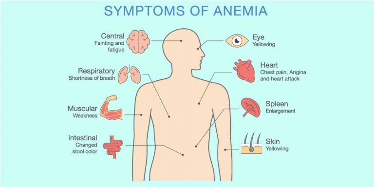 Anemia And Piles How Are They Related Home Remedies 2170