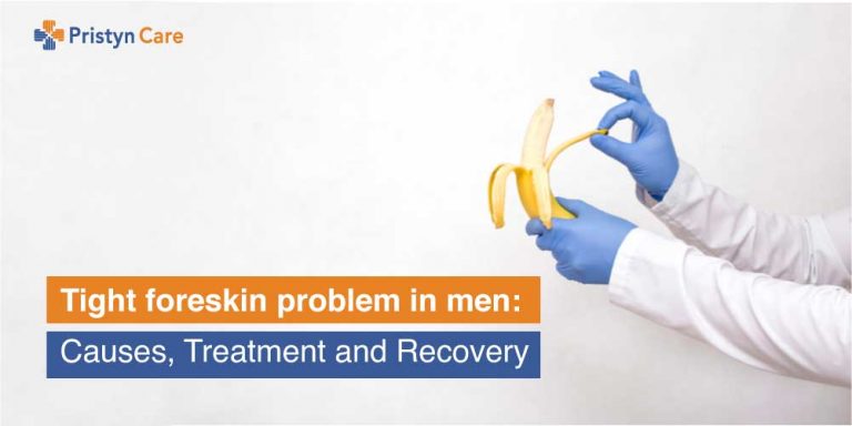 tight-foreskin-problem-in-men-causes-treatment-and-recovery