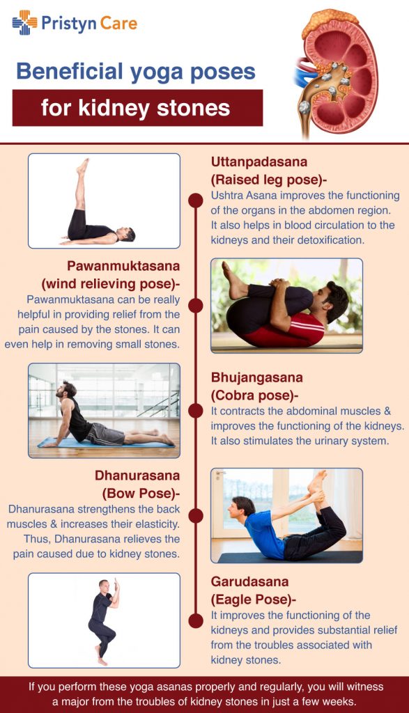किडनी स्टोन के इलाज के लिए बेस्ट योगासन (Yoga for kidney stone in Hindi) -  Pristyn Care