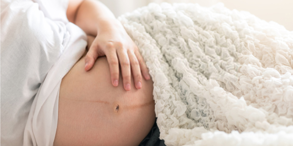 Leaking Fluid During Pregnancy: What It Means