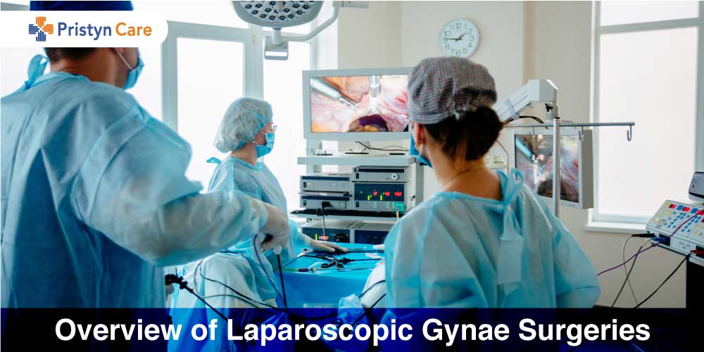 Doctors performing Laparoscopic Gynae Surgeries