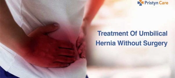 3 Ways To Treat Umbilical Hernia Without Surgery Pristyn Care