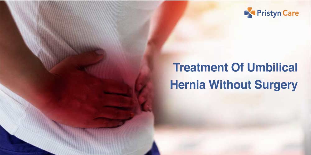 3 Ways To Treat Umbilical Hernia Without Surgery