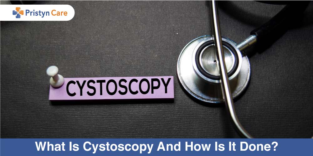 cystoscopy