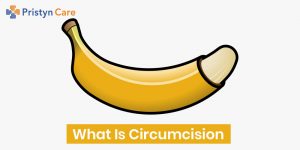 Which Circumcision Technique Is Better? - Pristyn Care