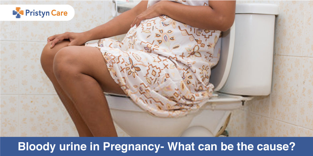 https://www.pristyncare.com/blog/wp-content/uploads/2020/05/Bloody-urine-in-Pregnancy-What-can-be-the-cause.jpg