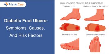 Diabetic Foot Ulcers- Symptoms, Causes, And Risk Factors - Pristyn Care