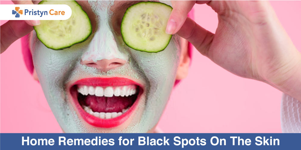 Home-Remedies-for-Black-Spots-On-The-Skin