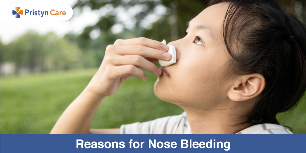 reasons-for-nose-bleeding-pristyn-care