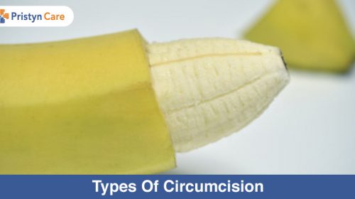 Laser Circumcision- Procedure and Advantages - Pristyn Care