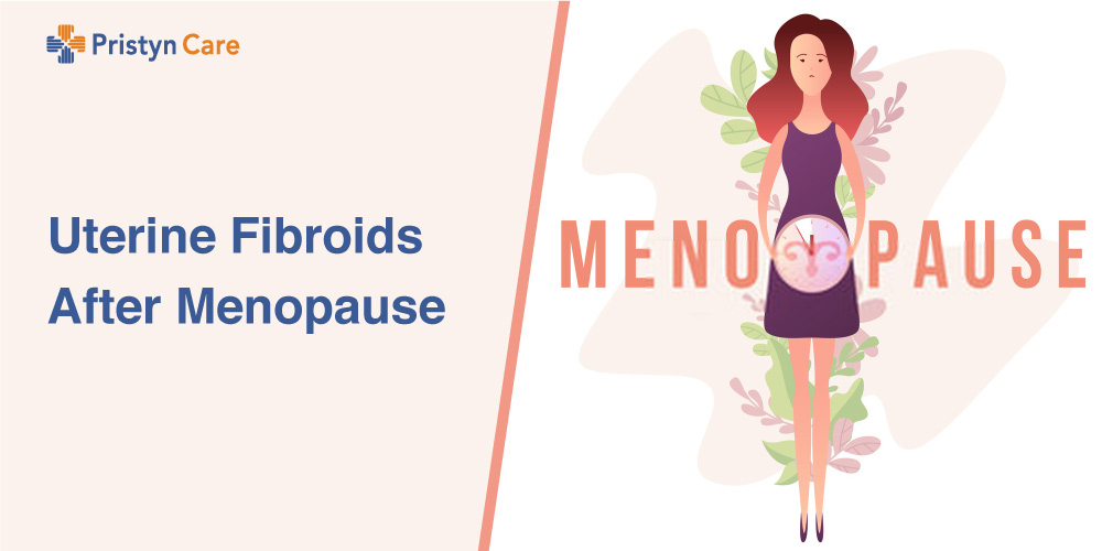 Uterine Fibroids After Menopause - Pristyn Care