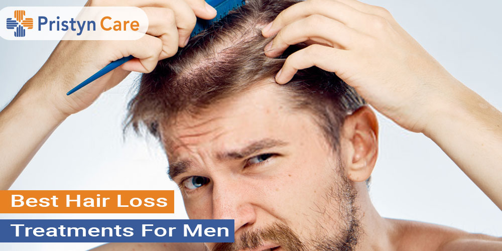 Hair Loss Solutions for Men Top 5 Treatments for Balding and Thinning Hair  Lines  Vanilla Luxury