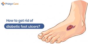 Diabetic Foot Ulcers- Symptoms, Causes, And Risk Factors - Pristyn Care